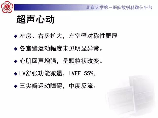 【病例】心肌淀粉样变性1例MR影像诊断