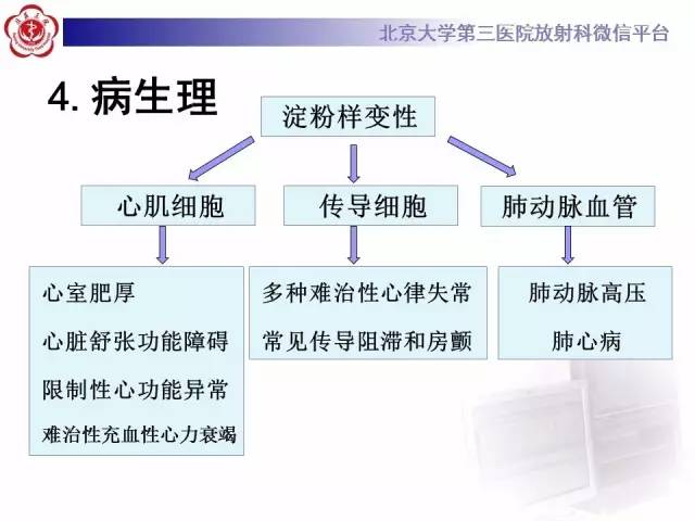 【病例】心肌淀粉样变性1例MR影像诊断