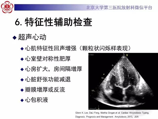 【病例】心肌淀粉样变性1例MR影像诊断