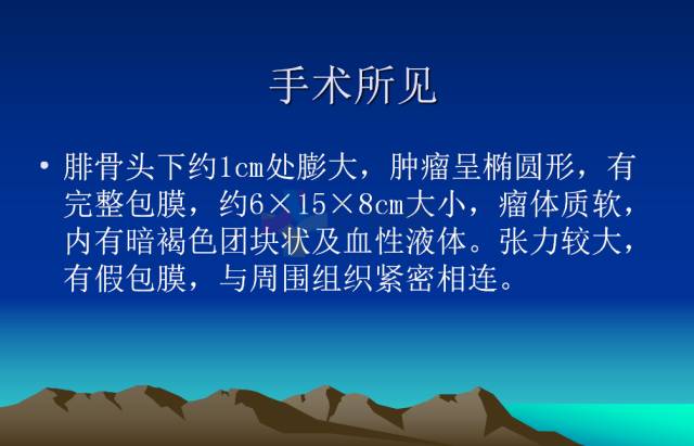 【PPT】恶性骨肿瘤的影像学诊断