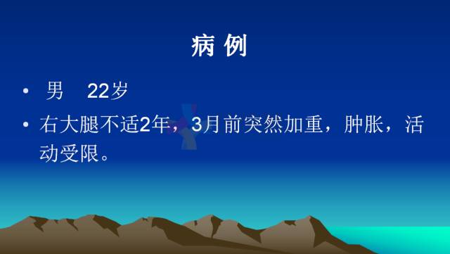 【PPT】恶性骨肿瘤的影像学诊断