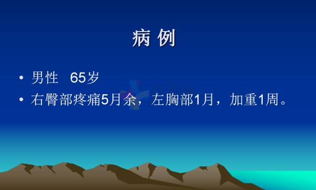 【PPT】恶性骨肿瘤的影像学诊断
