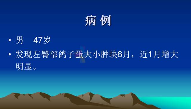 【PPT】恶性骨肿瘤的影像学诊断