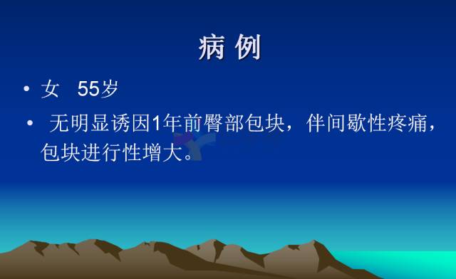 【PPT】恶性骨肿瘤的影像学诊断