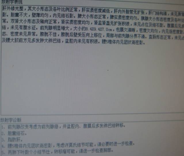 【PPT】恶性骨肿瘤的影像学诊断