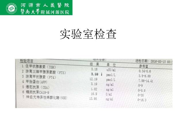 【病例】肠系膜根部淋巴瘤1例CT影像表现 【病例】肠系膜根部淋巴瘤1例CT影像表现