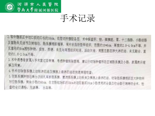【病例】肠系膜根部淋巴瘤1例CT影像表现 【病例】肠系膜根部淋巴瘤1例CT影像表现