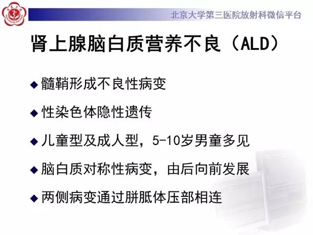 【病例】原发性胼胝体变性1例MR