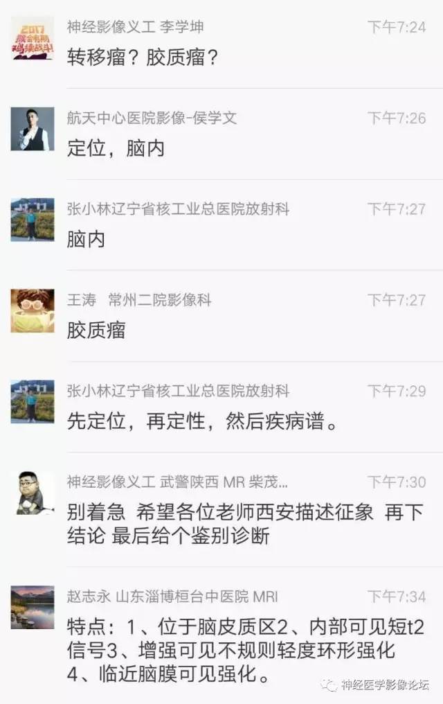 【病例】脑脱髓鞘假瘤1例MR影像讨论