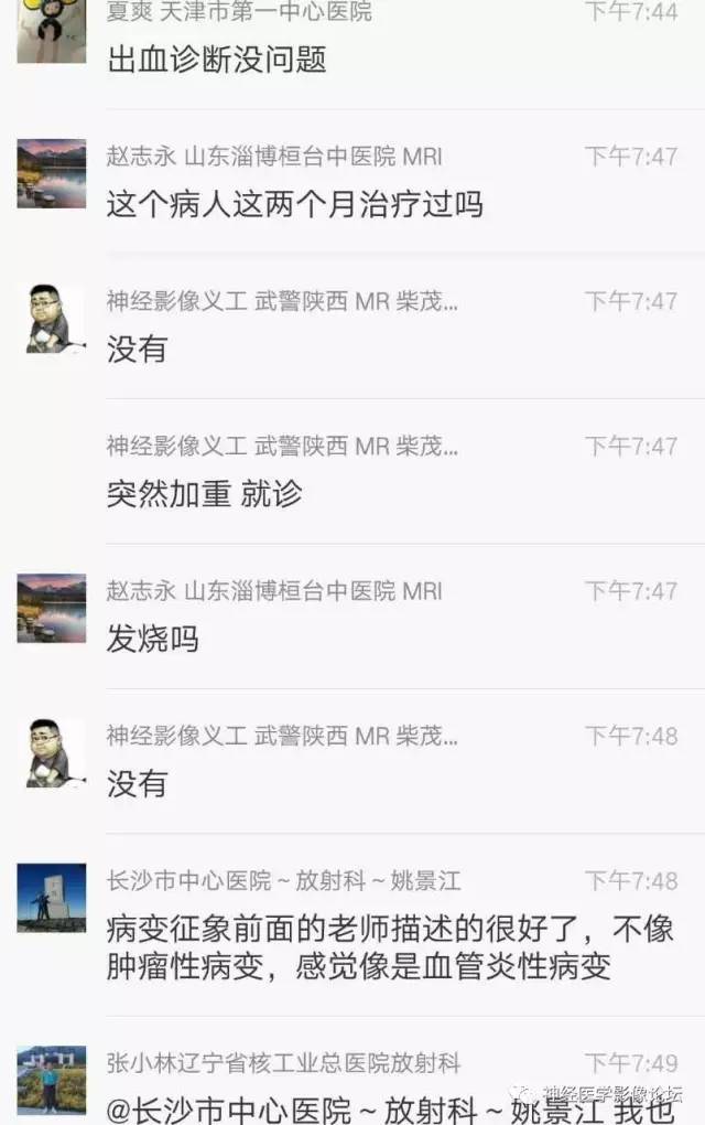【病例】脑脱髓鞘假瘤1例MR影像讨论