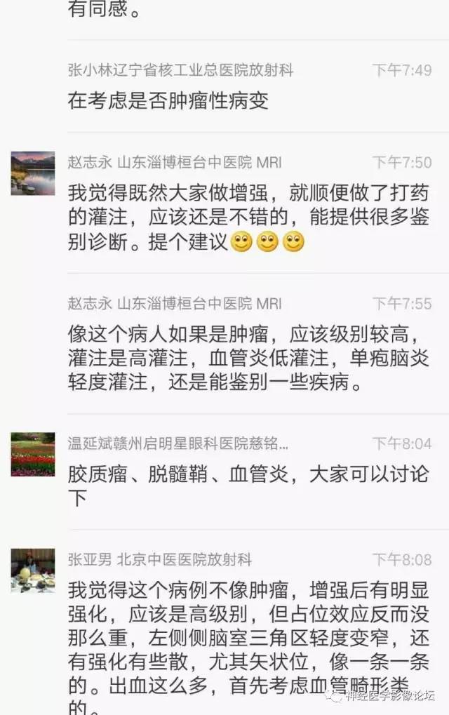 【病例】脑脱髓鞘假瘤1例MR影像讨论