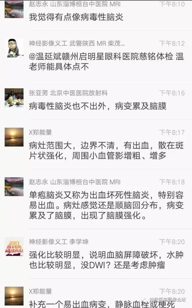 【病例】脑脱髓鞘假瘤1例MR影像讨论