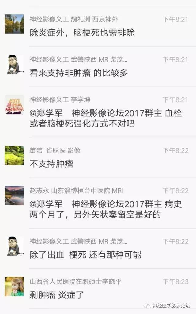 【病例】脑脱髓鞘假瘤1例MR影像讨论