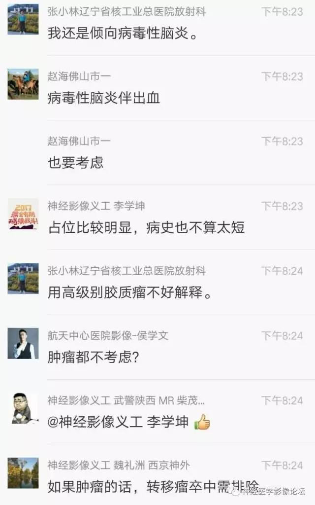【病例】脑脱髓鞘假瘤1例MR影像讨论
