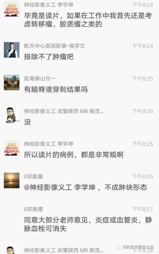 【病例】脑脱髓鞘假瘤1例MR影像讨论