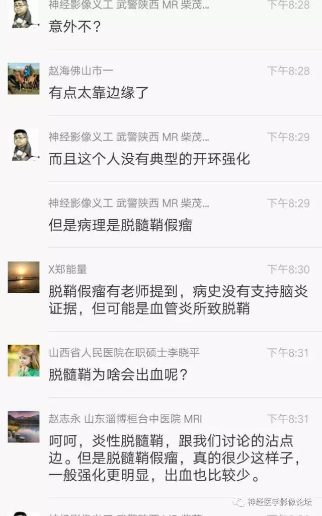 【病例】脑脱髓鞘假瘤1例MR影像讨论