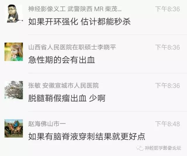 【病例】脑脱髓鞘假瘤1例MR影像讨论