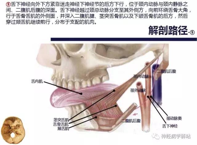 【PPT】舌下神经解剖、影像及临床 【PPT】舌下神经解剖、影像及临床