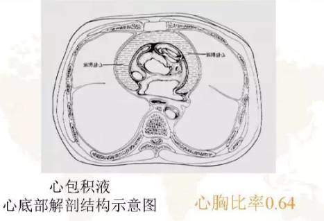 胸部影像学征象——