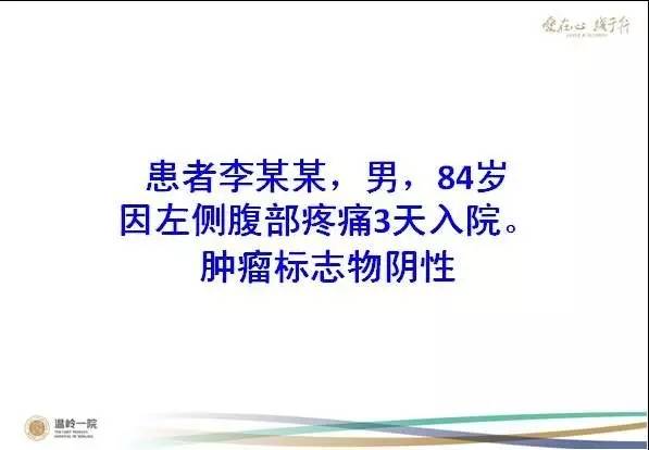 【病例】腹膜后异位嗜铬细胞瘤1例CT