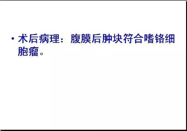 【病例】腹膜后异位嗜铬细胞瘤1例CT