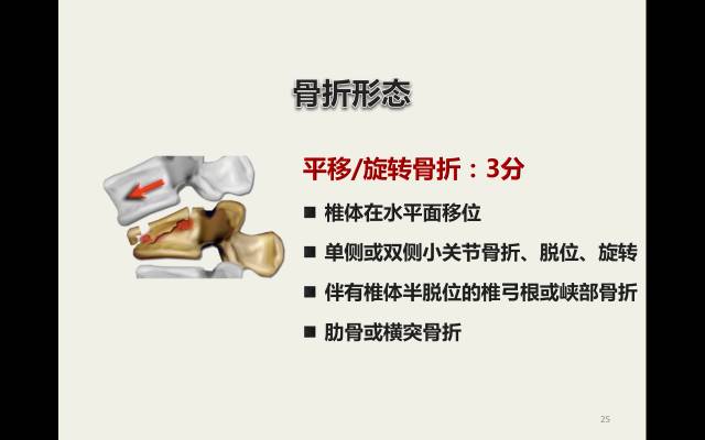 【病例】胸腰椎损伤分型及严重程度评分(TLICS)：影像与临床