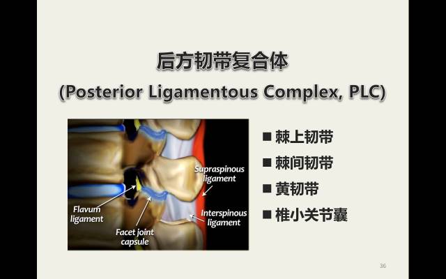 【病例】胸腰椎损伤分型及严重程度评分(TLICS)：影像与临床