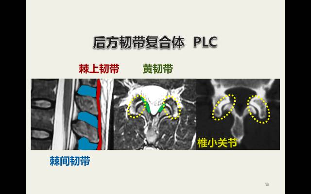【病例】胸腰椎损伤分型及严重程度评分(TLICS)：影像与临床