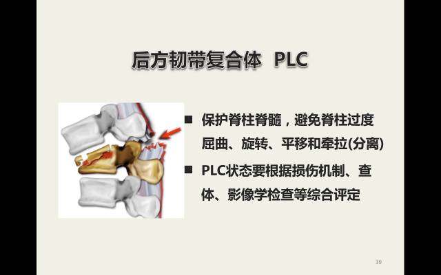 【病例】胸腰椎损伤分型及严重程度评分(TLICS)：影像与临床