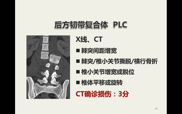 【病例】胸腰椎损伤分型及严重程度评分(TLICS)：影像与临床