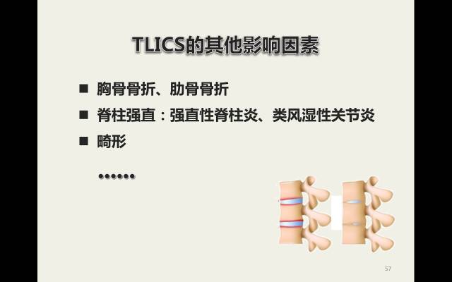 【病例】胸腰椎损伤分型及严重程度评分(TLICS)：影像与临床