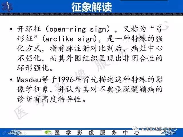 【影像征象】开环征——脱髓鞘假瘤