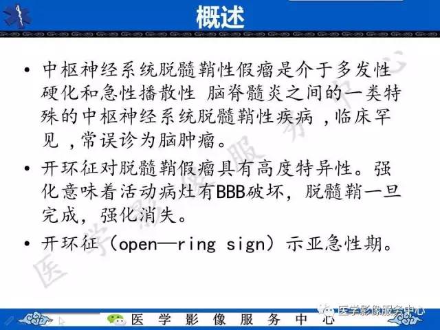【影像征象】开环征——脱髓鞘假瘤