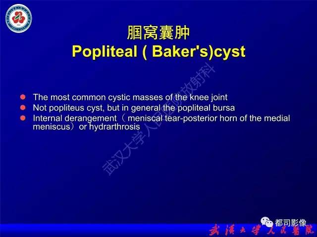 【PPT】膝关节常见囊性病变MRI诊断