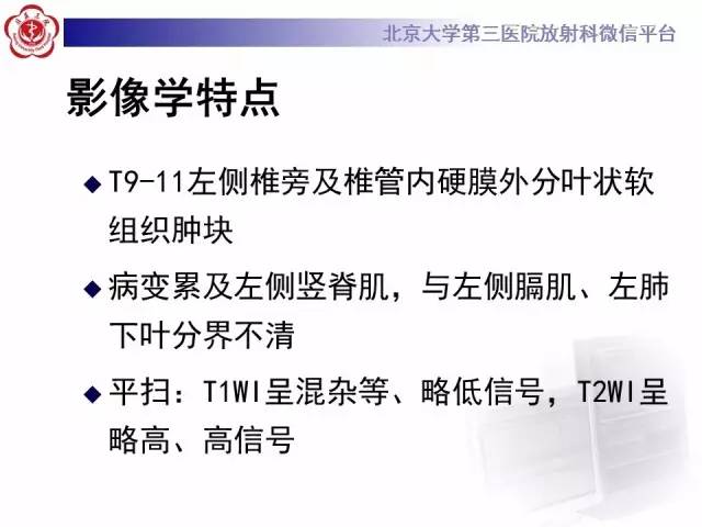 【病例】脊柱孤立性纤维瘤1例MR