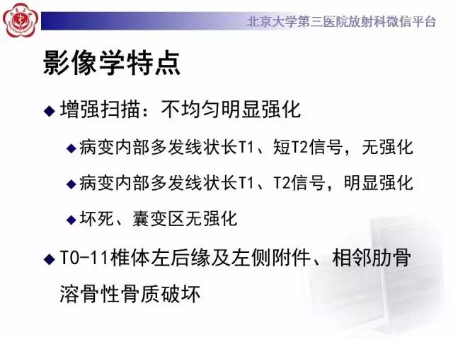 【病例】脊柱孤立性纤维瘤1例MR