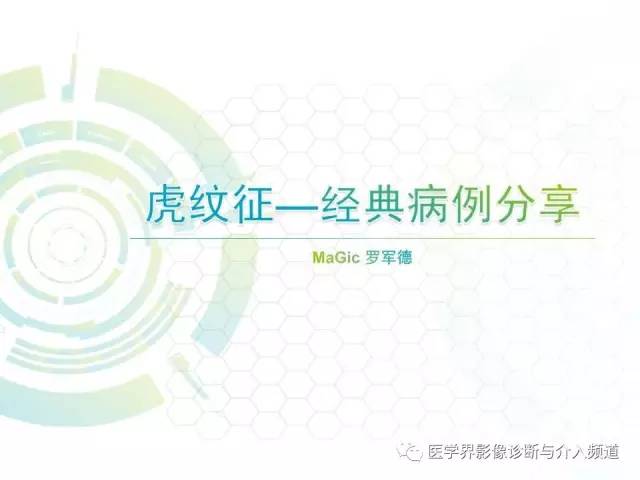 【病例】异染性脑白质营养不良1例MR影像诊断