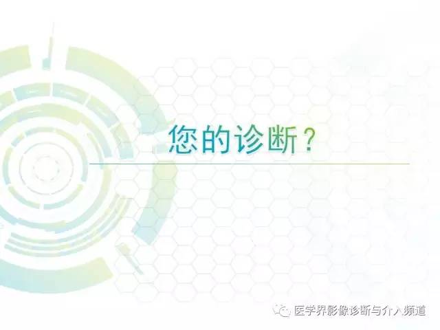 【病例】异染性脑白质营养不良1例MR影像诊断