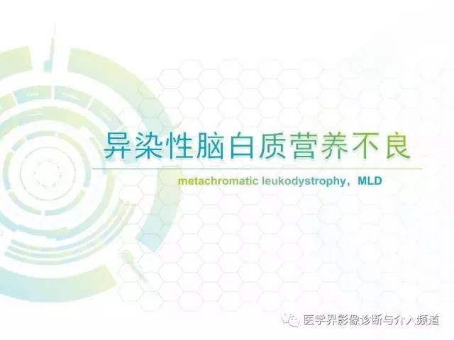 【病例】异染性脑白质营养不良1例MR影像诊断