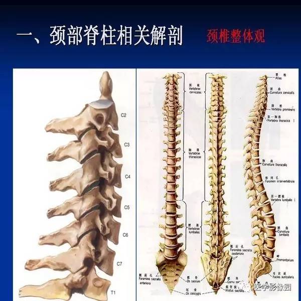 【PPT】颈椎病影像诊断