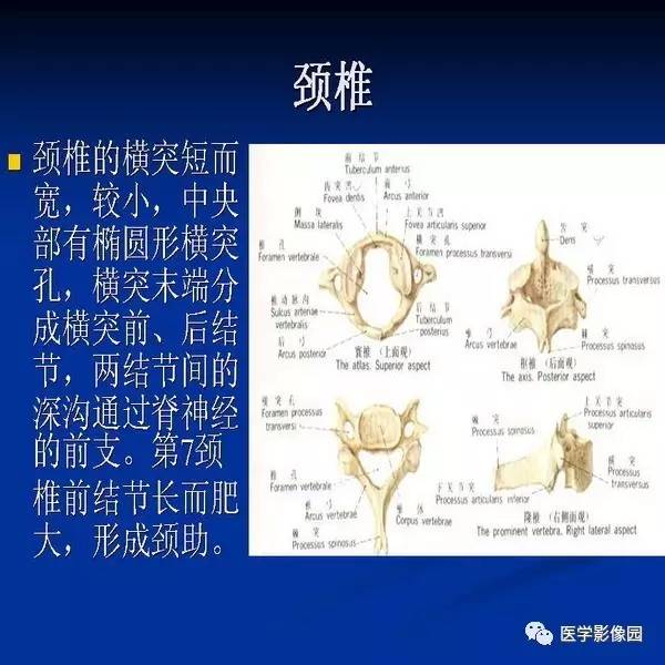 【PPT】颈椎病影像诊断