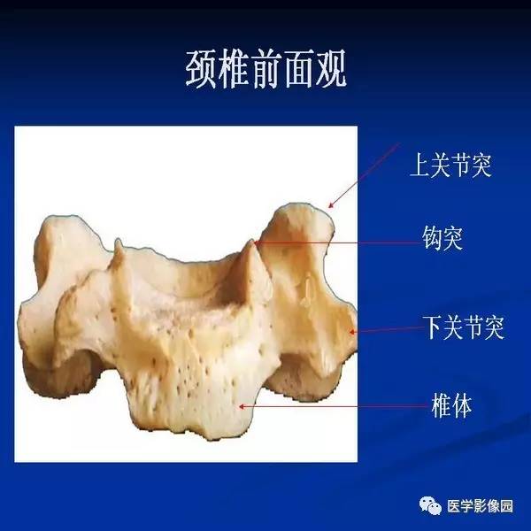 【PPT】颈椎病影像诊断