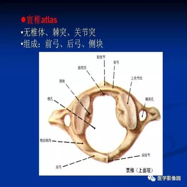【PPT】颈椎病影像诊断