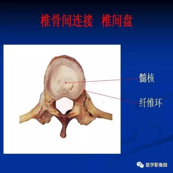 【PPT】颈椎病影像诊断