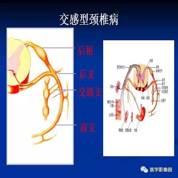 【PPT】颈椎病影像诊断