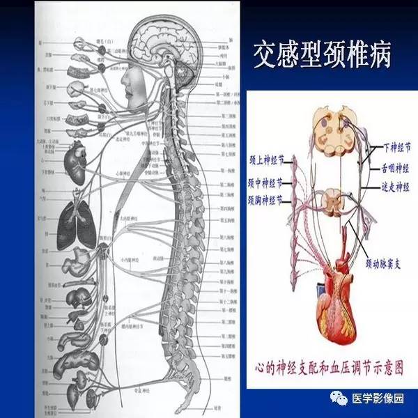 【PPT】颈椎病影像诊断