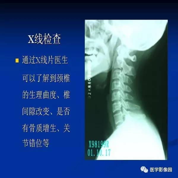 【PPT】颈椎病影像诊断