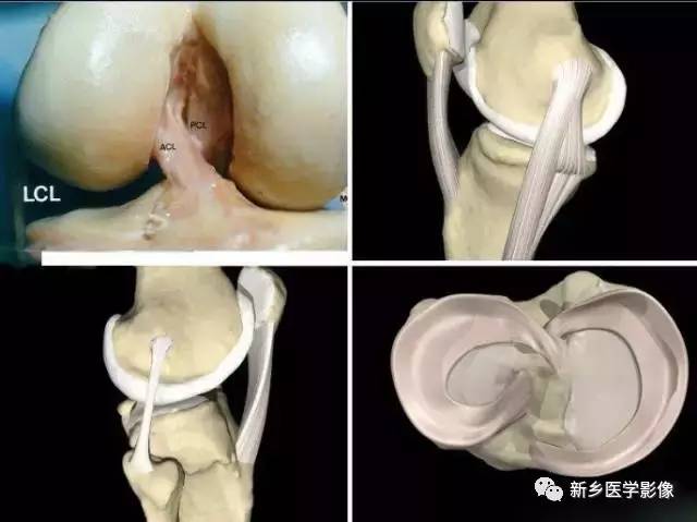 膝关节疼痛,应想到的22种疾病 膝关节疼痛,应想到的22种疾病