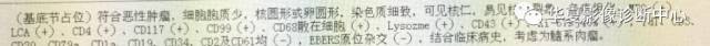 【病例】粒细胞肉瘤伴出血1例MR影像表现