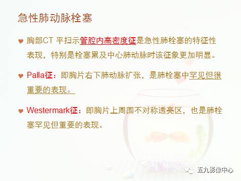 【病例】血管高密度征——急性肺动脉栓塞1例CT影像表现 【病例】血管高密度征——急性肺动脉栓塞1例CT影像表现